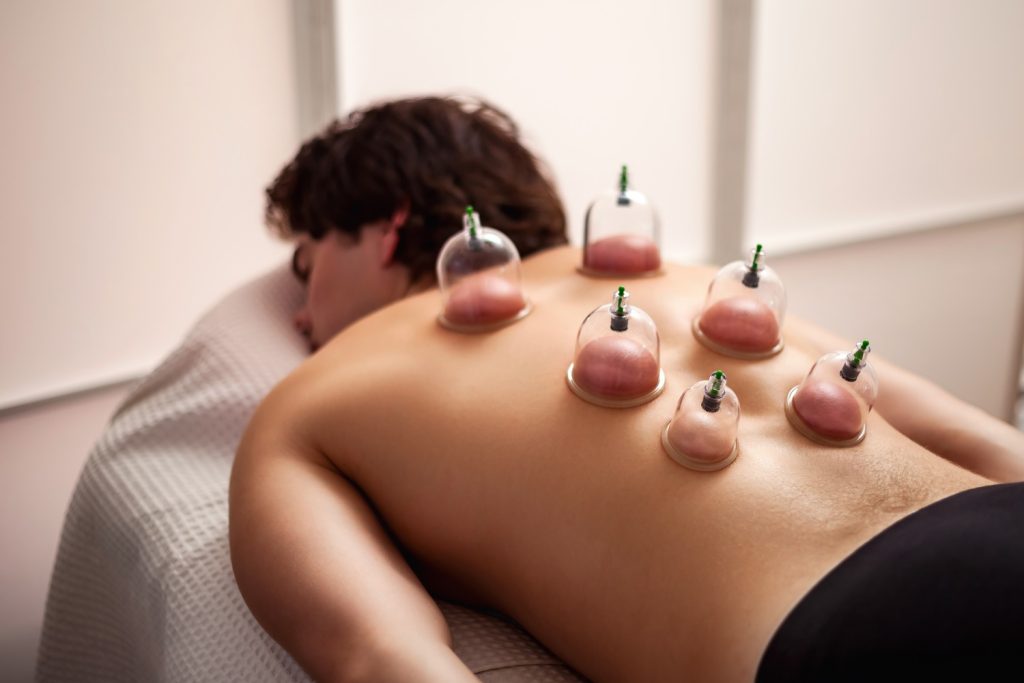 cupping massage therapy