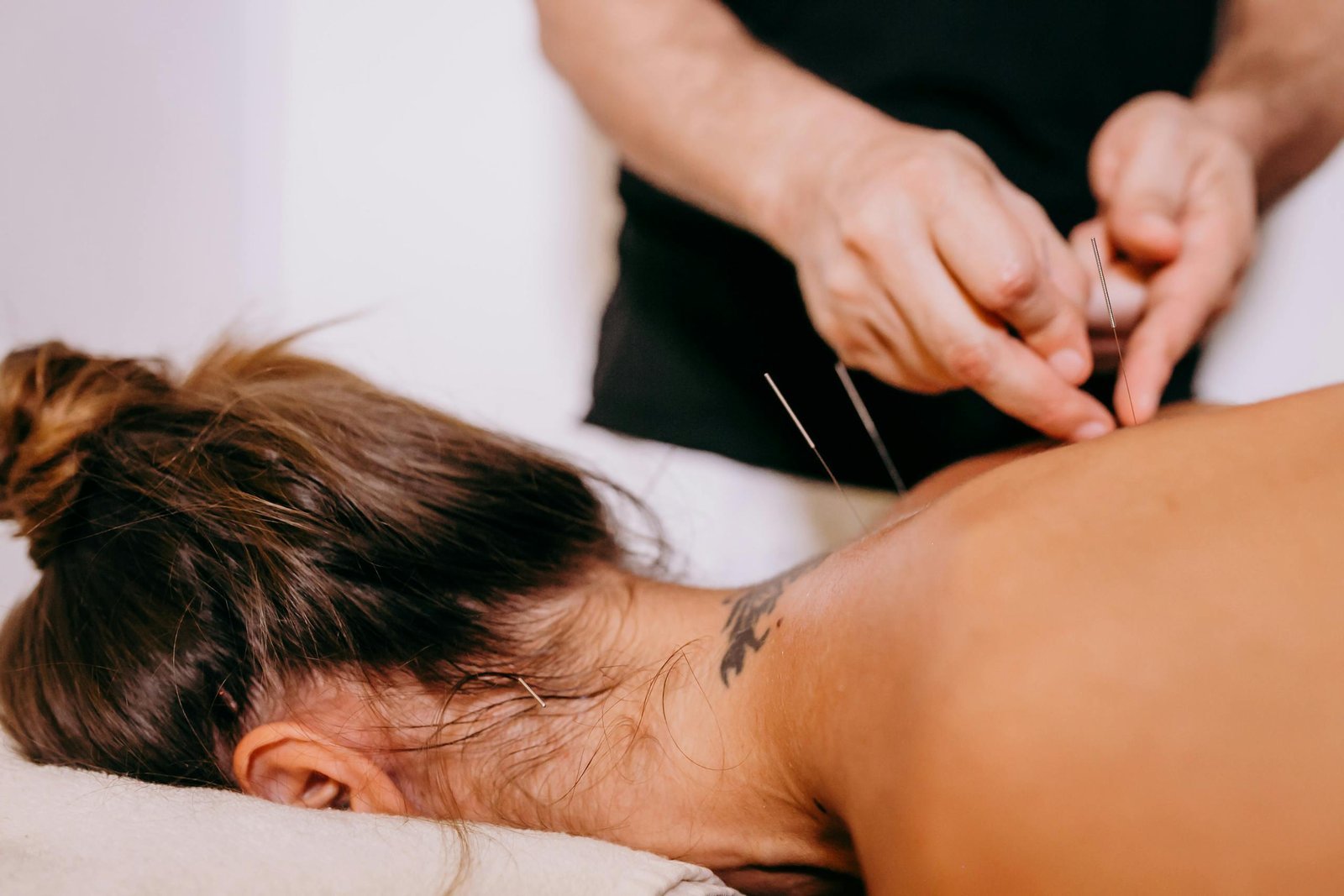 close-up-of-acupuncture-needles-being-inserted-on-a-womans-back-during-therapy-promoting-relaxation-and-wellness.-4353249-scaled