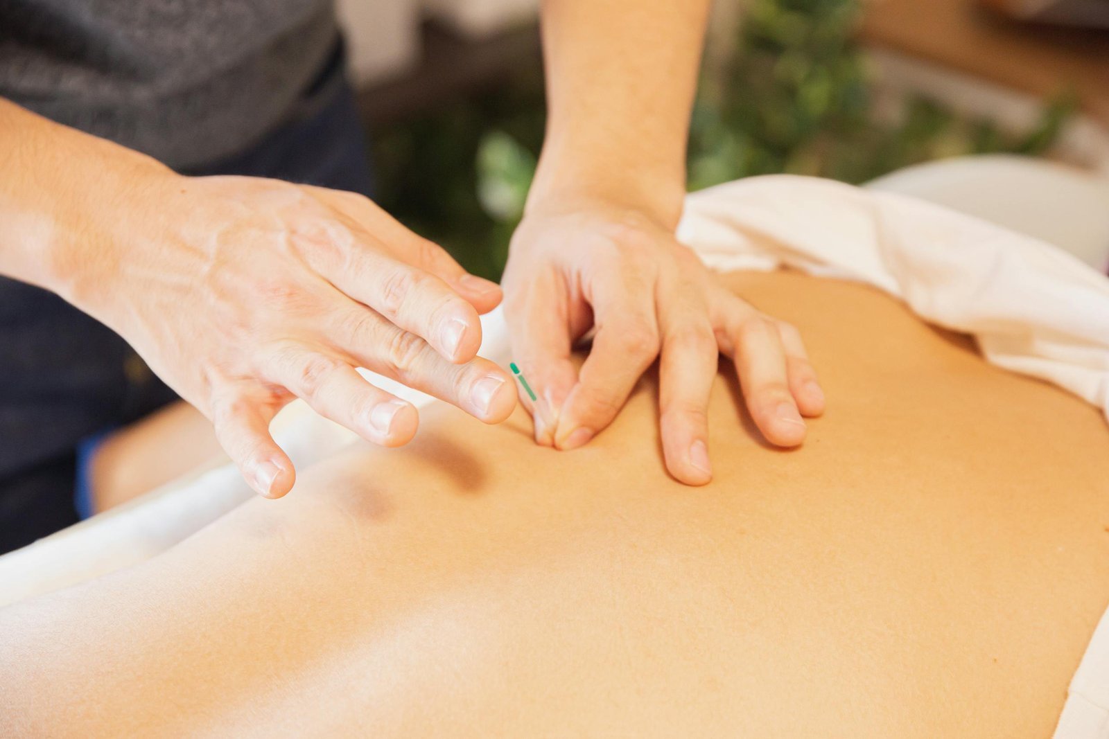 from-above-of-crop-anonymous-man-applying-needles-on-back-of-client-during-acupuncture-procedure-5473180-scaled
